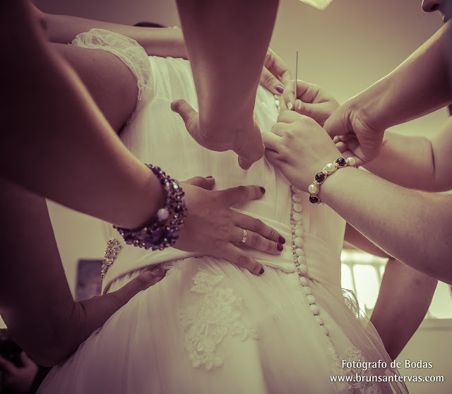 Los botones del vestido